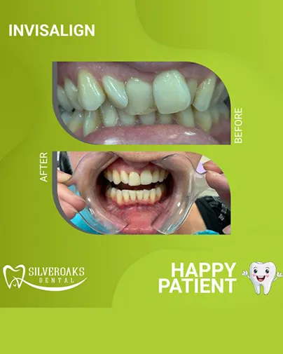 Smile transformation 6