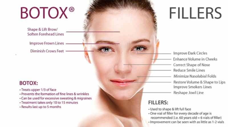 Dermal Fillers